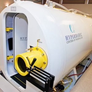 Hyperbaric Chambers for Sale - Contact our resident HBOT specialist